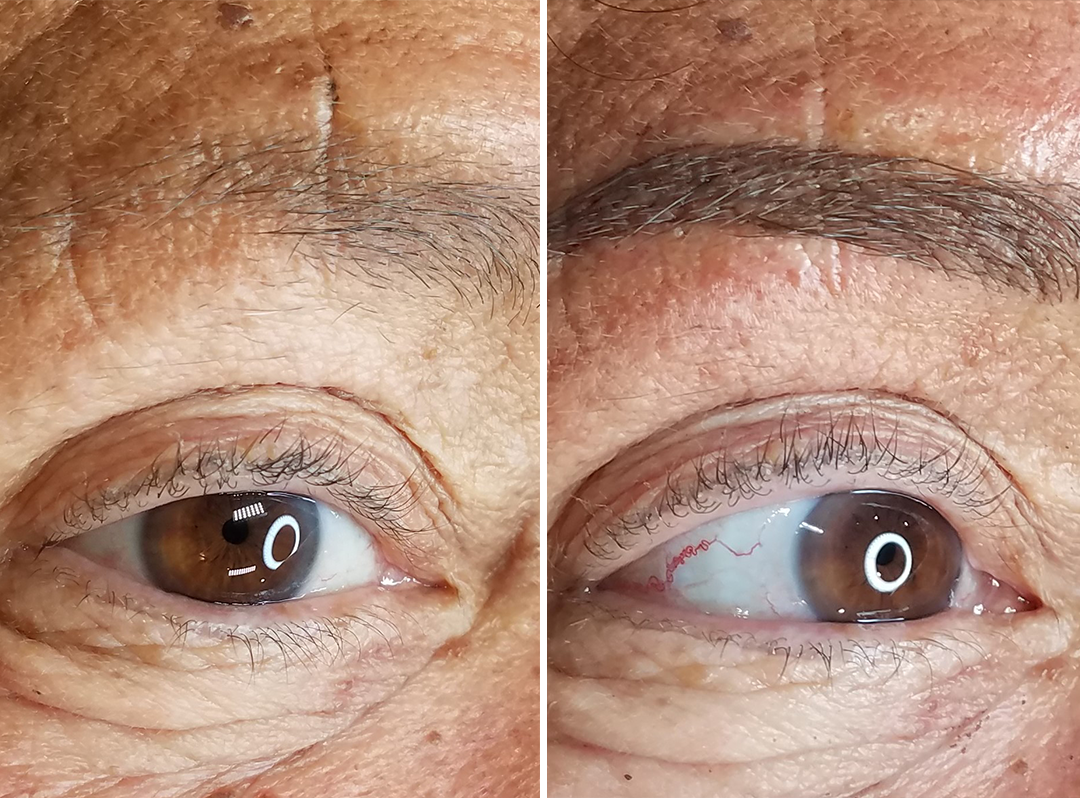 microblading-before-after-2