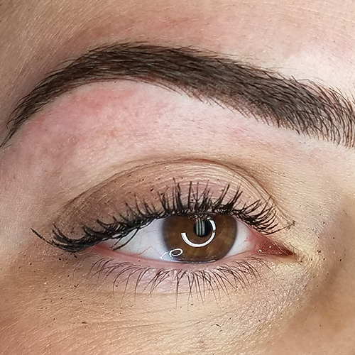 microblading-before-img-new-hover
