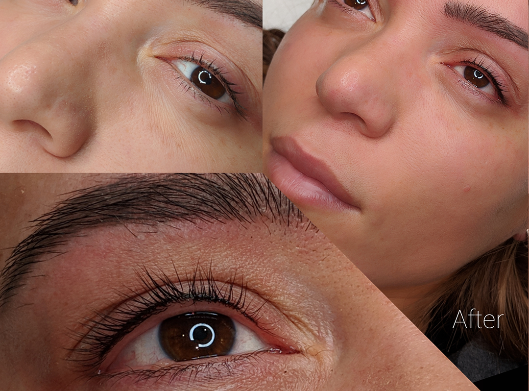permanent-eyeliner-before-after-img2